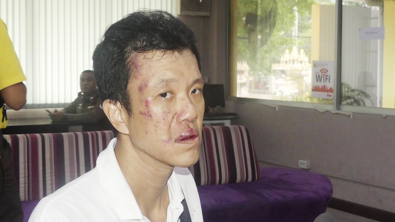 ระทึก! "เอกชัย หงส์กังวาน" เจอชกหน้าบวมปูด ป้ายรถเมล์หน้าศาลอาญา 