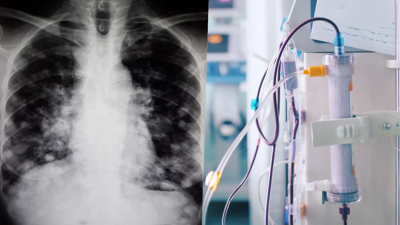 หมอสุภัทร ตอบคำถามยอดฮิต คนออกกำลังกาย กินอาหารคลีน แต่ทำไมเป็นมะเร็ง