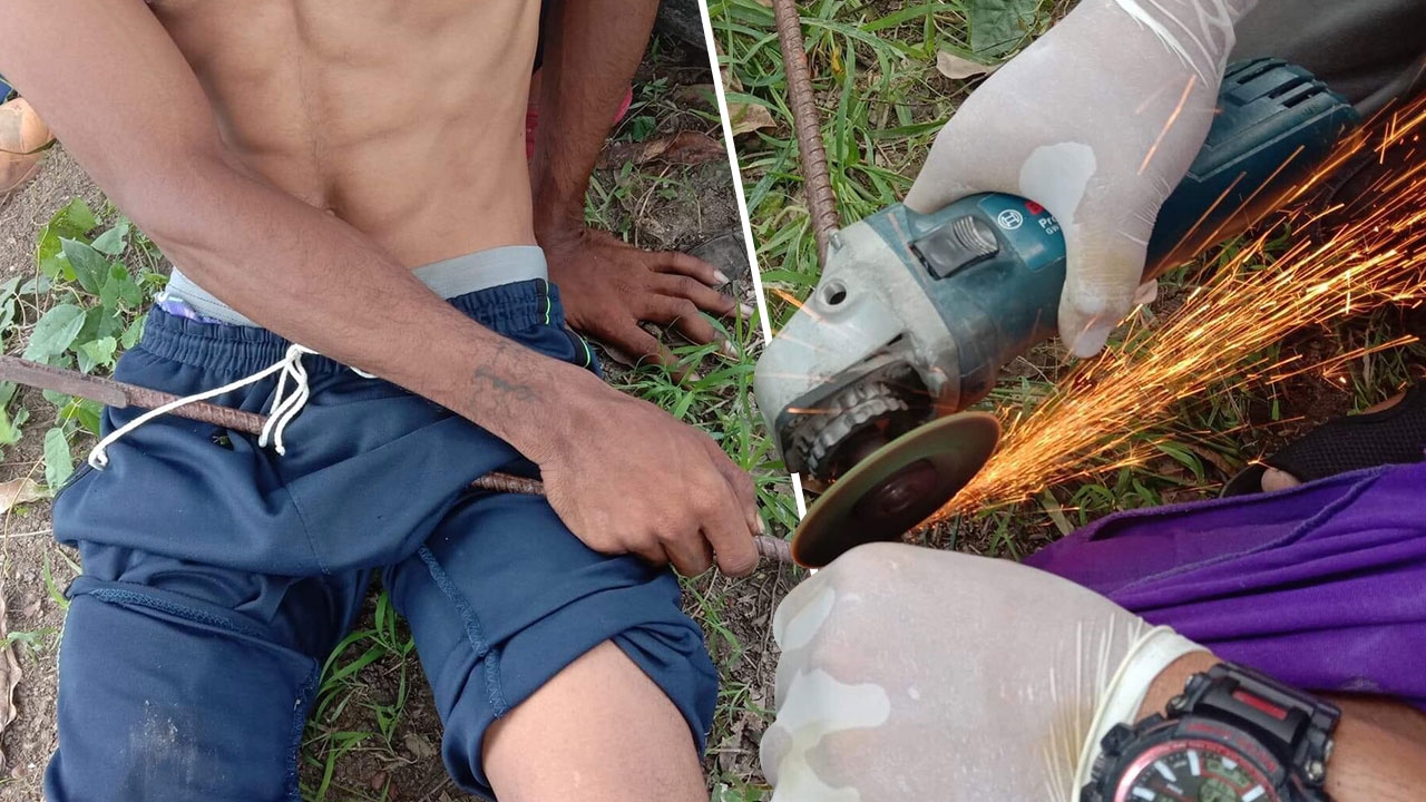 หนุ่มดวงจู๋ปีนเก็บมะม่วง ร่วงตกถูกเหล็กเสียบคาพวงสวรรค์