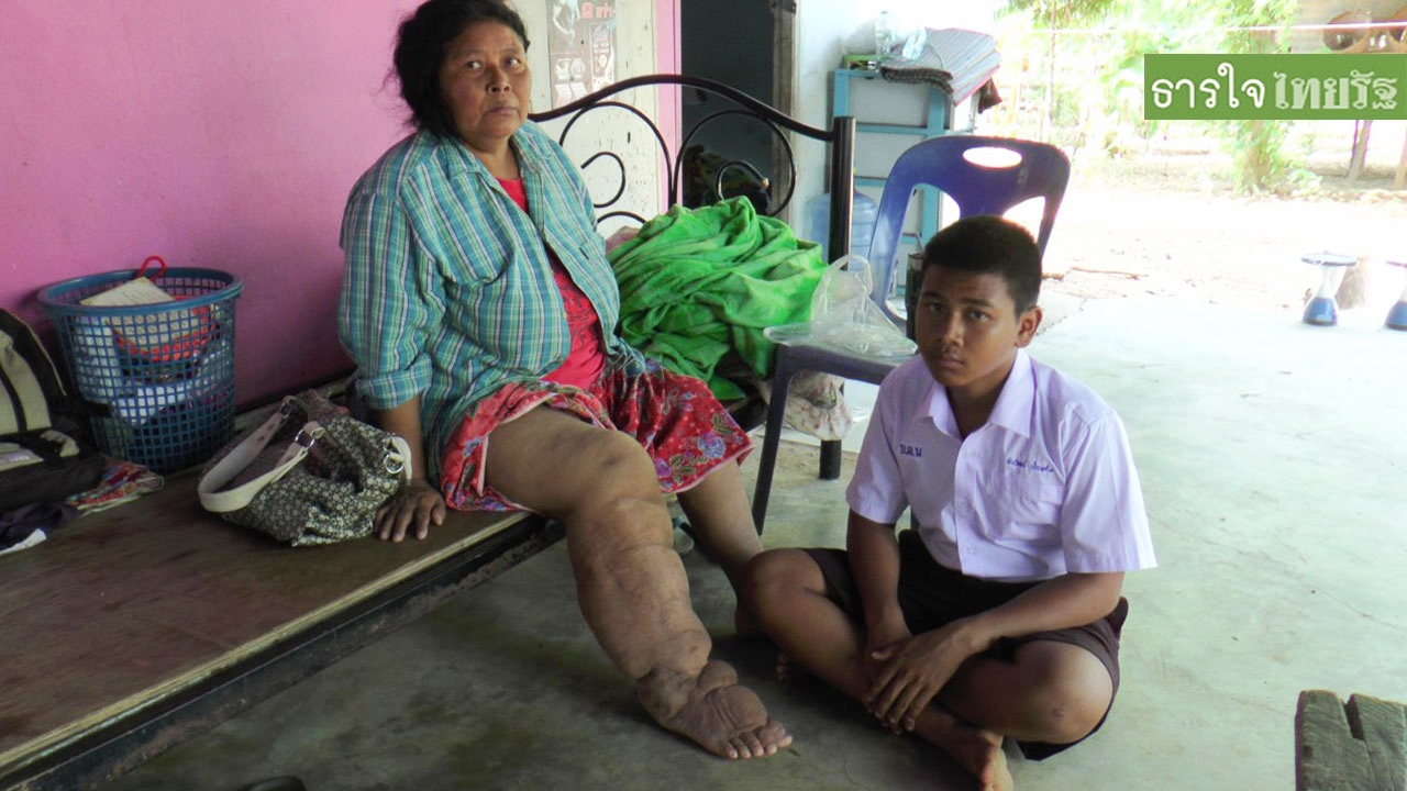แบกภาระเกินวัย "น้องโอม" ด.ช.ยอดกตัญญู ทำงาน เลี้ยงยายตาป่วยติดเตียง