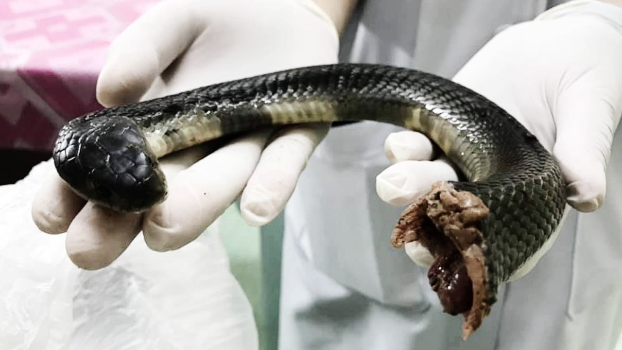 หมอแทบช็อก ญาติเด็ก 13 หอบ "งูเห่า" มาโรงพยาบาล โชคดีมาแค่ครึ่งตัว