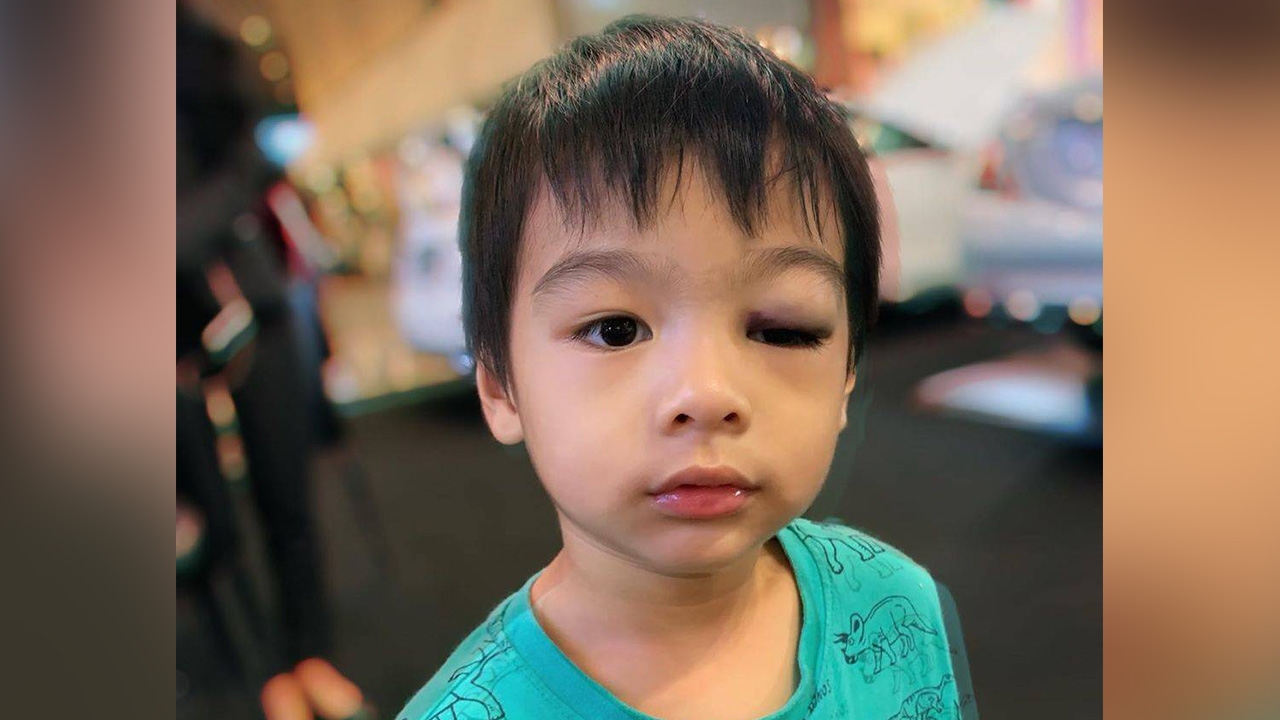 เห็นแล้วตกใจ น้องโอลาฟ ลูกชาย โอ๊ต วรวุฒิ ตกจากที่สูง 2 เมตร