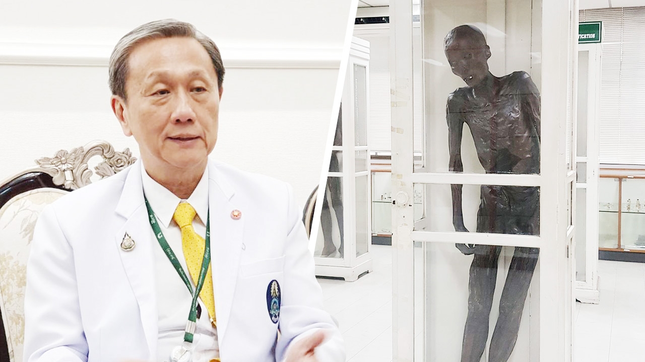 เล็งใช้เทคโนโลยี 3D จำลองร่าง "ซีอุย" ศึกษาเนื้องอกในสมอง พบมีผลต่อพฤติกรรม