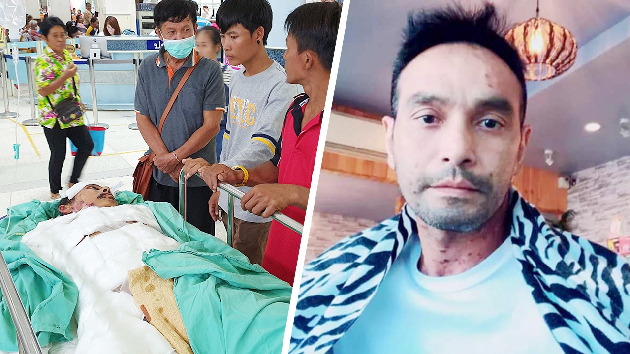 เผยหนุ่มวังทอง หนังเน่า ป่วย "เพมฟิกัส" โรคเดียวกับ วินัย ไกรบุตร