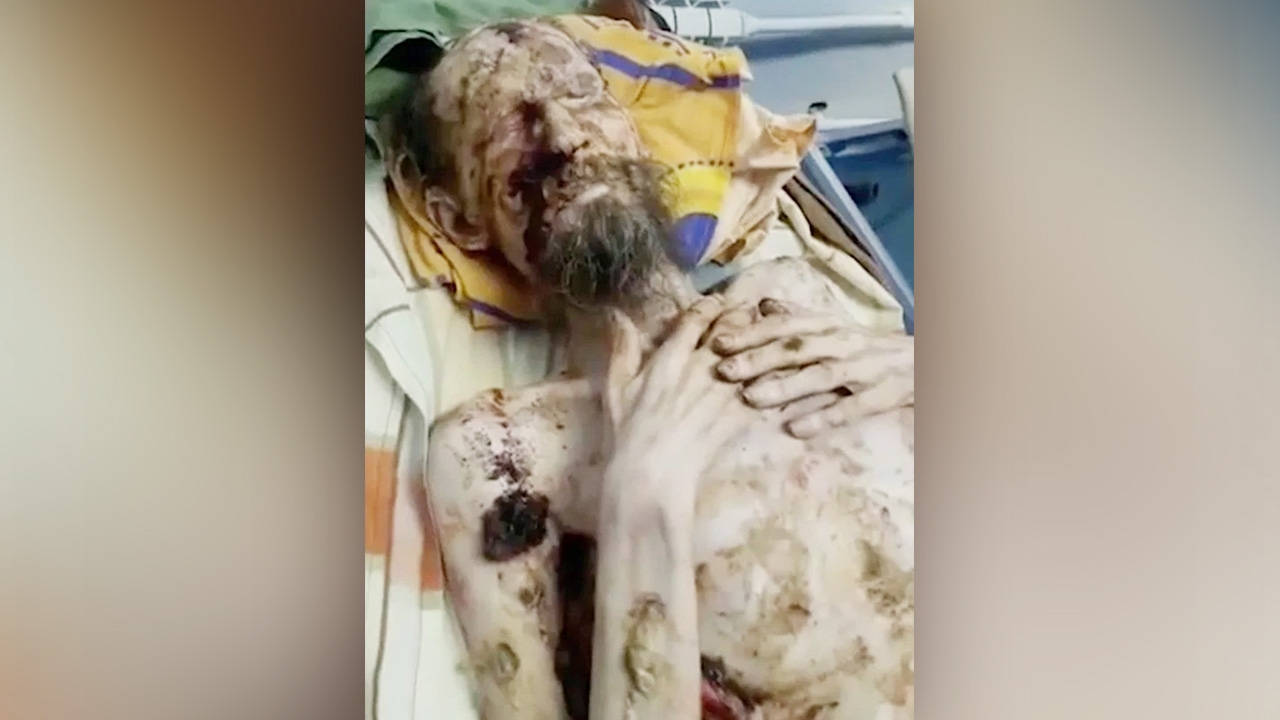 อึ้ง พบชายรัสเซียรอดตายในรังหมี หลังถูกหมีลากเข้าป่าเมื่อเดือนก่อน