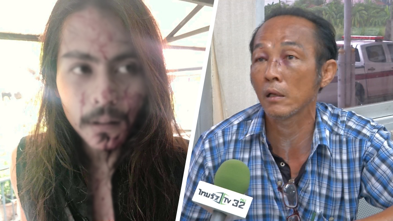 ลุงทุบหน้านักร้องเลือดอาบ อ้างเป็นผู้ป่วยจิตเวช หูแว่วได้ยินคนหาเรื่อง