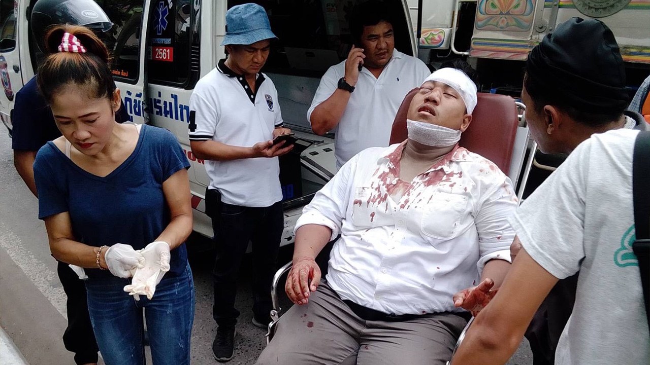 ไม้เบสบอลรุมฟาด “จ่านิว” ยำหน้าปากซอยบ้าน หัวแตกเลือดอาบหน้า