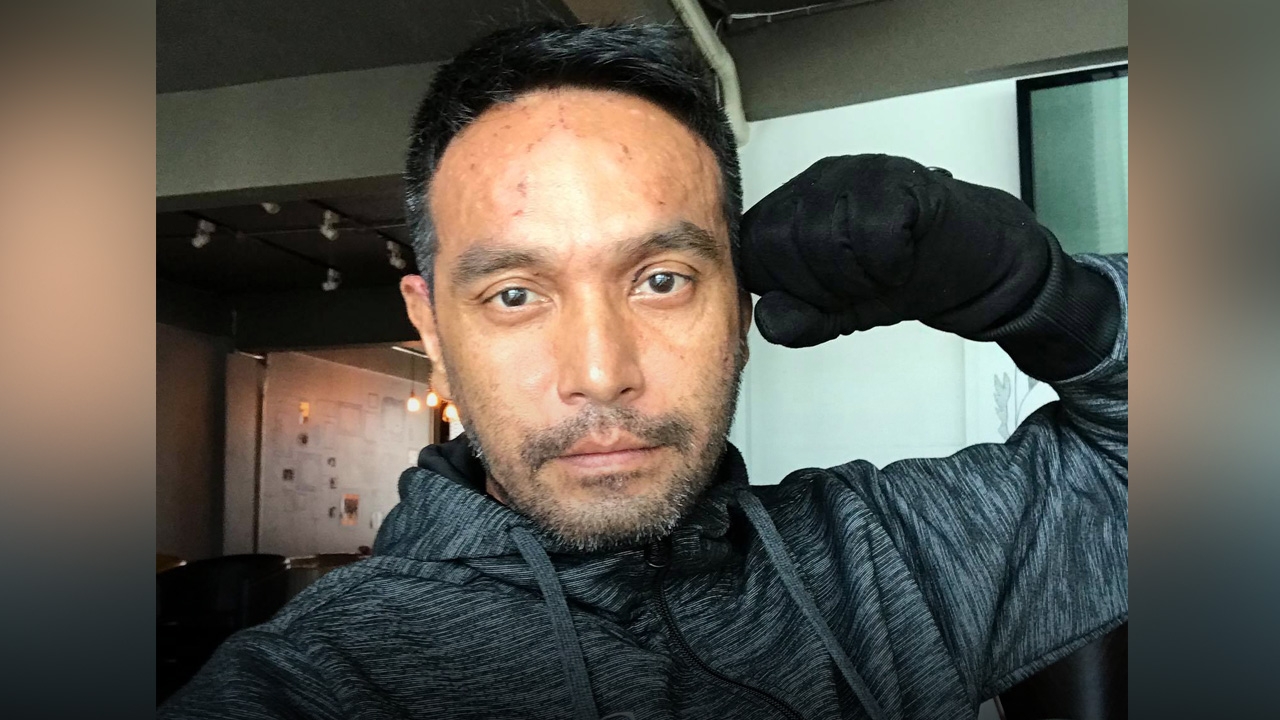 อัพเดตอาการ เมฆ วินัย หลังป่วยเป็นตุ่มน้ำพอง แอดมิทอีกรอบหลังมีอาการบวม