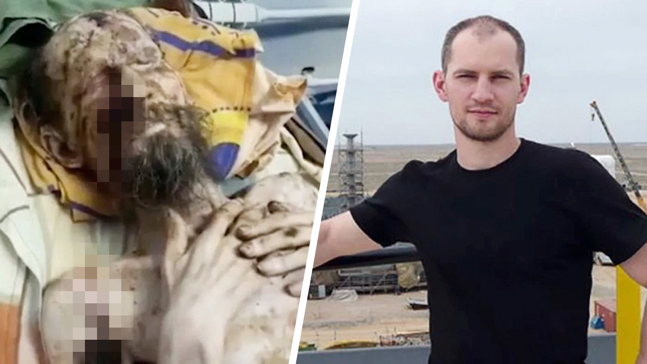 หมอคาซัคฯโต้สื่อรัสเซียตีข่าวชายโดนหมีทำร้าย ปางตาย ยันป่วยสะเก็ดเงิน