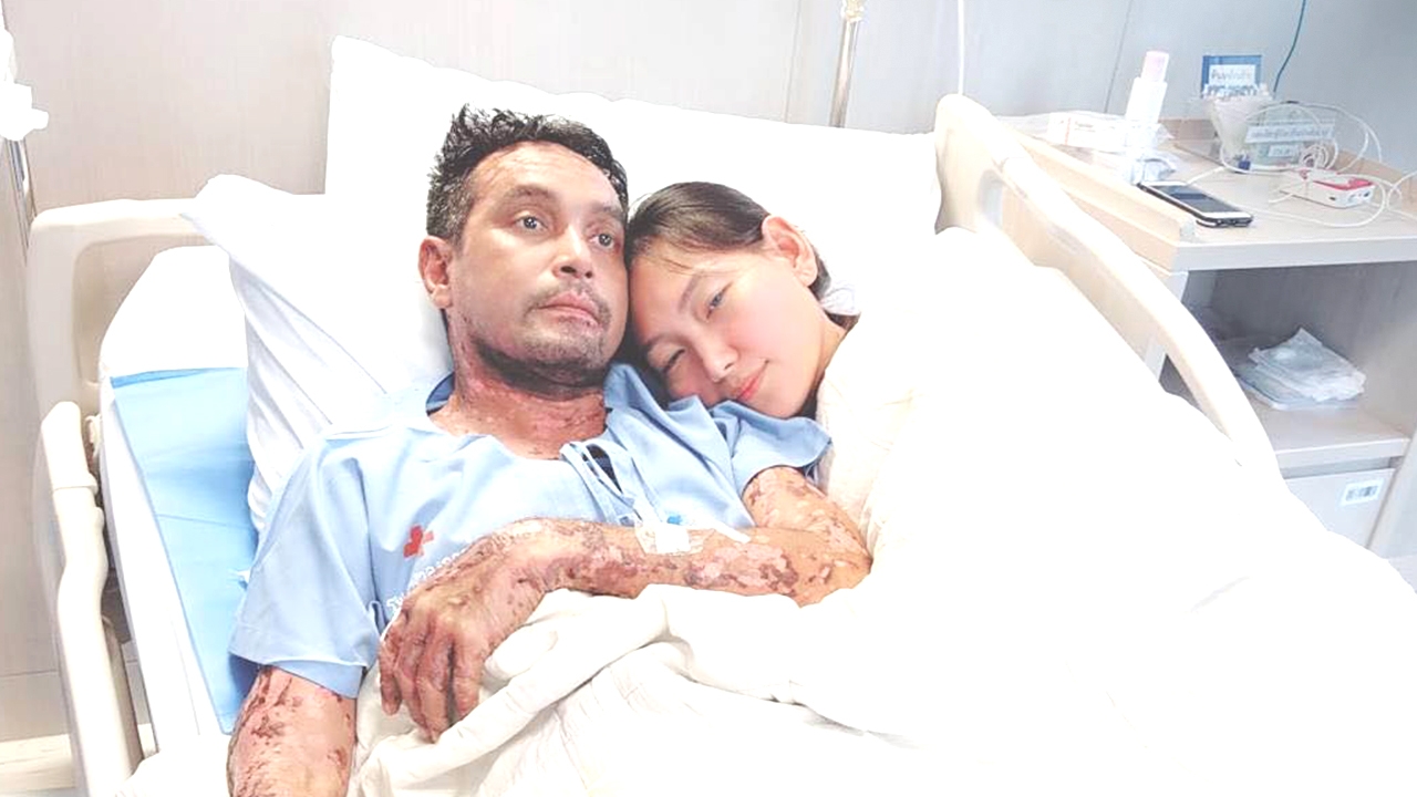 เมฆ วินัย โพสต์ซึ้งถึงภรรยา ในวันที่ล้มป่วยเป็นโรคตุ่มน้ำพอง