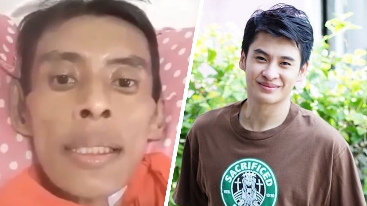 รู้จักโรค "ดาราเก่า" ธีร์ ภูมิธนะวัชร์ ไอ มีไข้ ภูมิต้านทานต่ำ แนะทางเลี่ยง