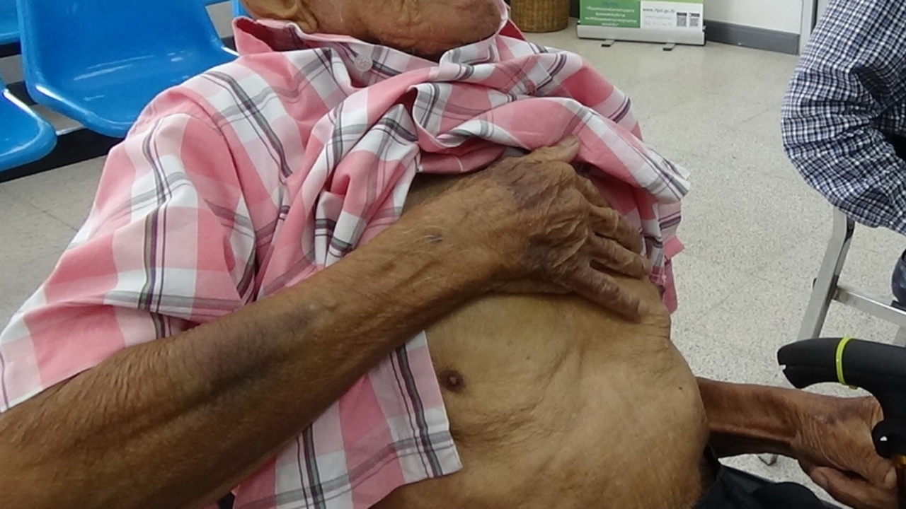 โวยพยาบาลห้องไอซียู ทุบอกพ่อ เอกซเรย์พบซี่โครงร้าว ด้าน รพ.เร่งสอบ