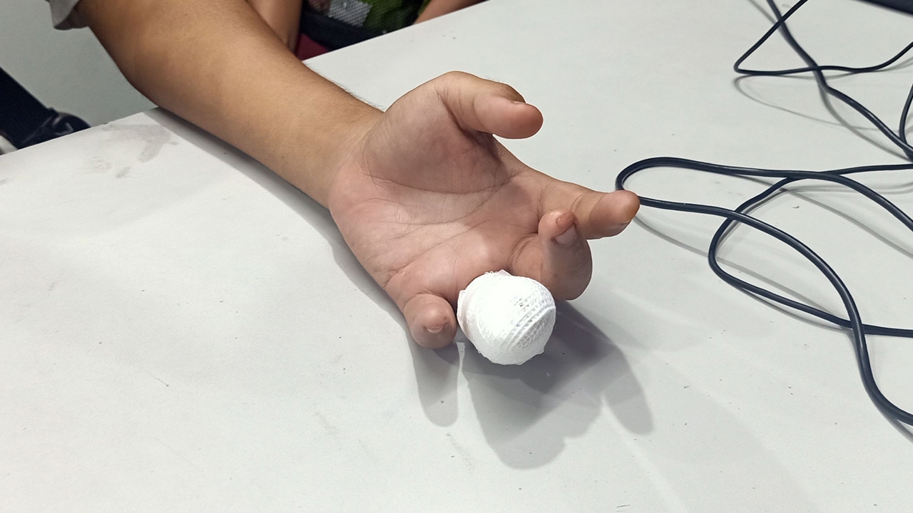 สุดหวาดเสียว หนุ่มวัย 18 ถูกประตูรถเมล์หนีบนิ้วนางข้างซ้ายขาด