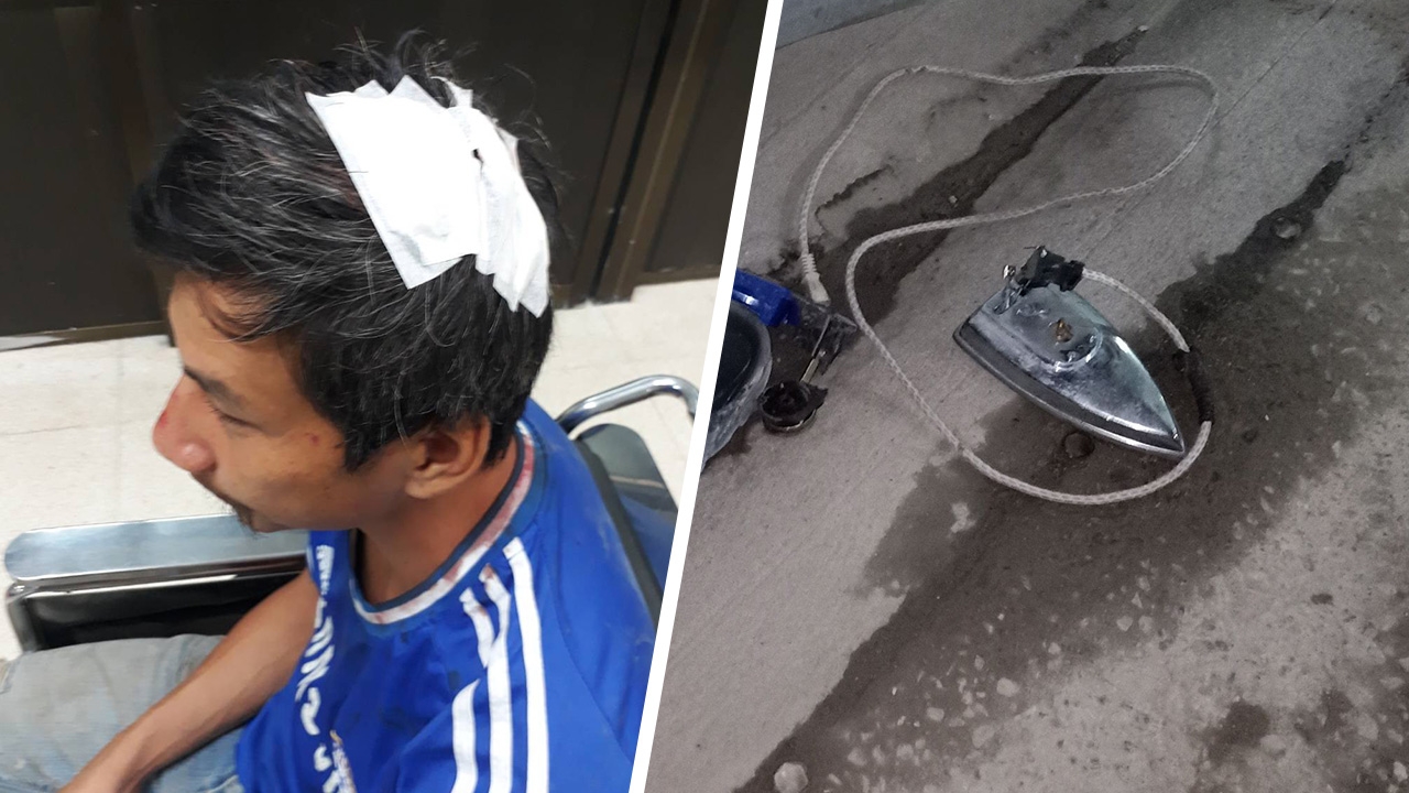 เตารีดจากเมียรัก โยนจากชั้น 4 ตกลงหัวผัวพอดี เย็บกว่า10 เข็ม  