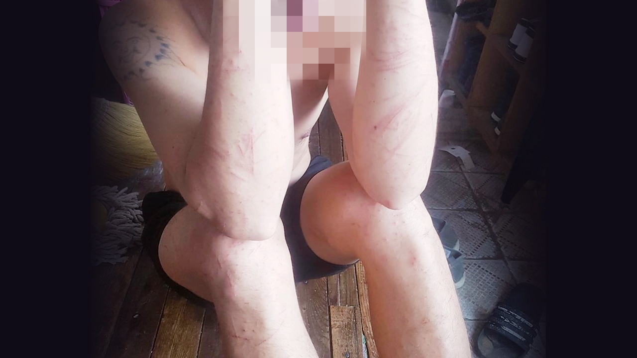 "ผีน้อย" โอดชีวิตลำบาก หลบหนี ตม.เกาหลี ซุกซ่อนตัว 7 ชม.ในดงไผ่