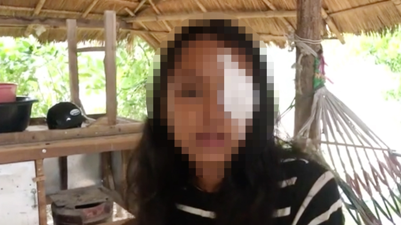 ครูปัดตั้งวงเหล้า แจงที่มา “ขวดโซดา” ต้นเหตุทำเด็กวัย 14 หวิดตาบอด