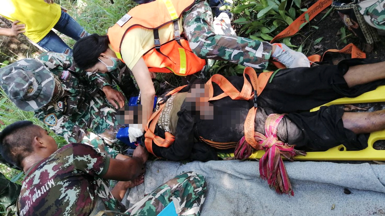 หนุ่มภูมิซรอลเข้าป่าเก็บเห็ด พลาดเหยียบกับระเบิดเท้าเละใกล้เขาพระวิหาร