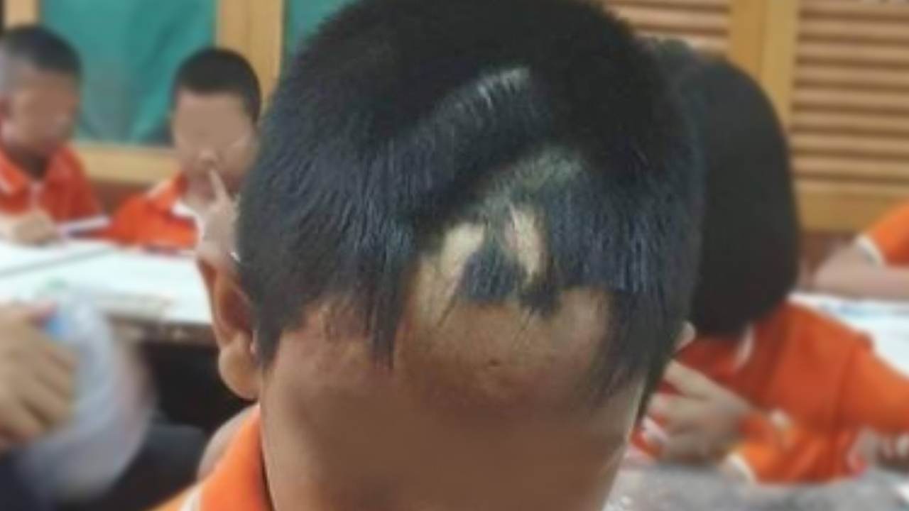 ผอ.แจงดราม่า ครูไถผมนักเรียนแหว่งเป็นหย่อม อ้างไม่รู้เด็กมีแผลเป็น