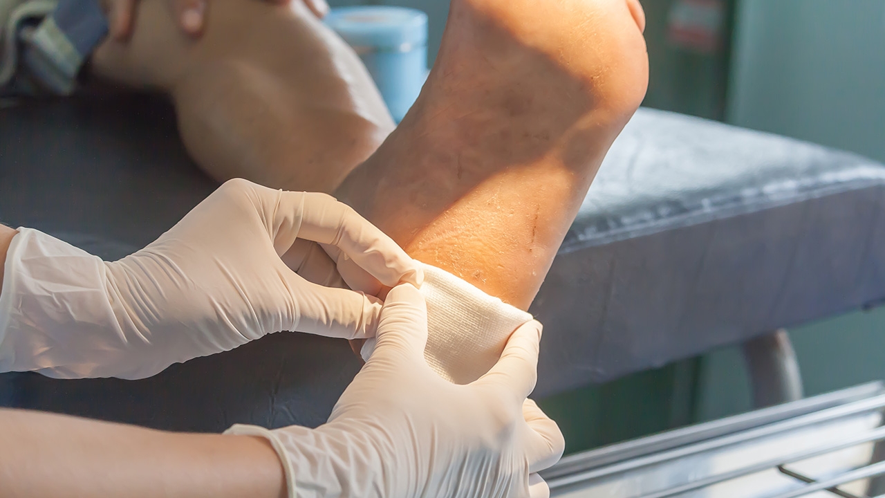 ยังไม่มีงานวิจัยรองรับ เตือนคนแชร์ "มหัศจรรย์ปัสสาวะ" อ้างล้างแผล รักษาโรค