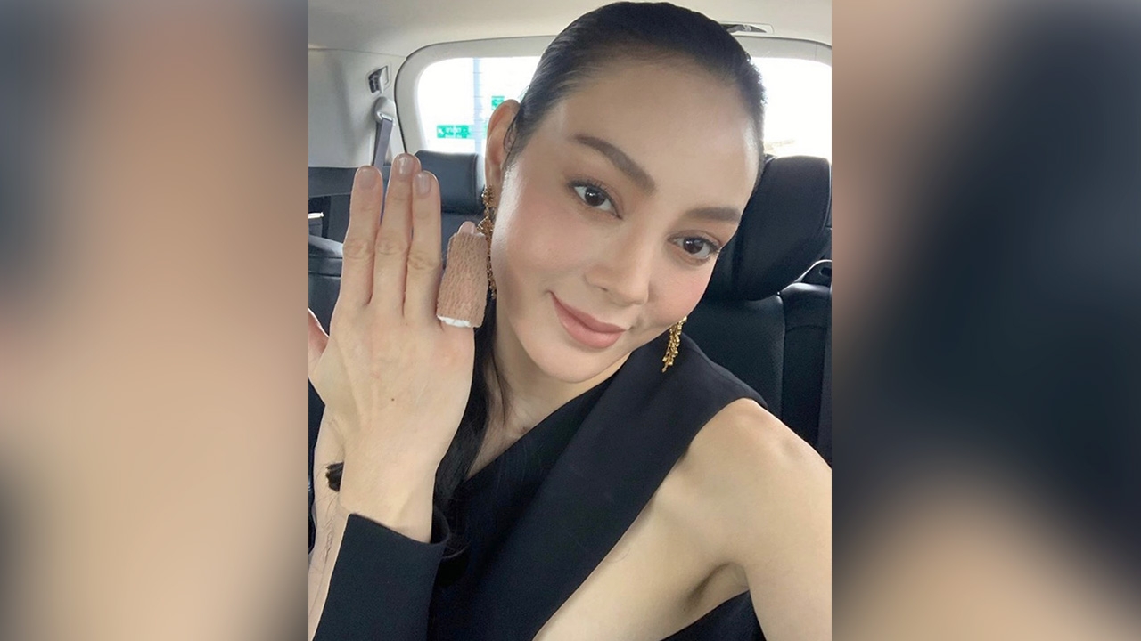 ตั๊ก บงกช โชว์แผลผ่าตัดที่นิ้วก้อย ชาวเน็ตห่วงแห่ถามว่าเป็นอะไร