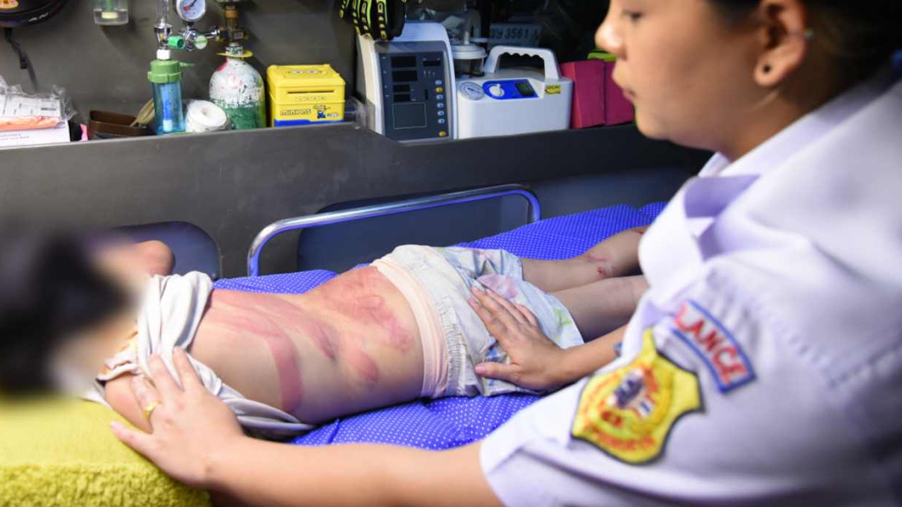 สลด แม่ตีลูก จับได้ขโมยเงินเหรียญ 100 บาท ฟาดไม่ยั้ง 