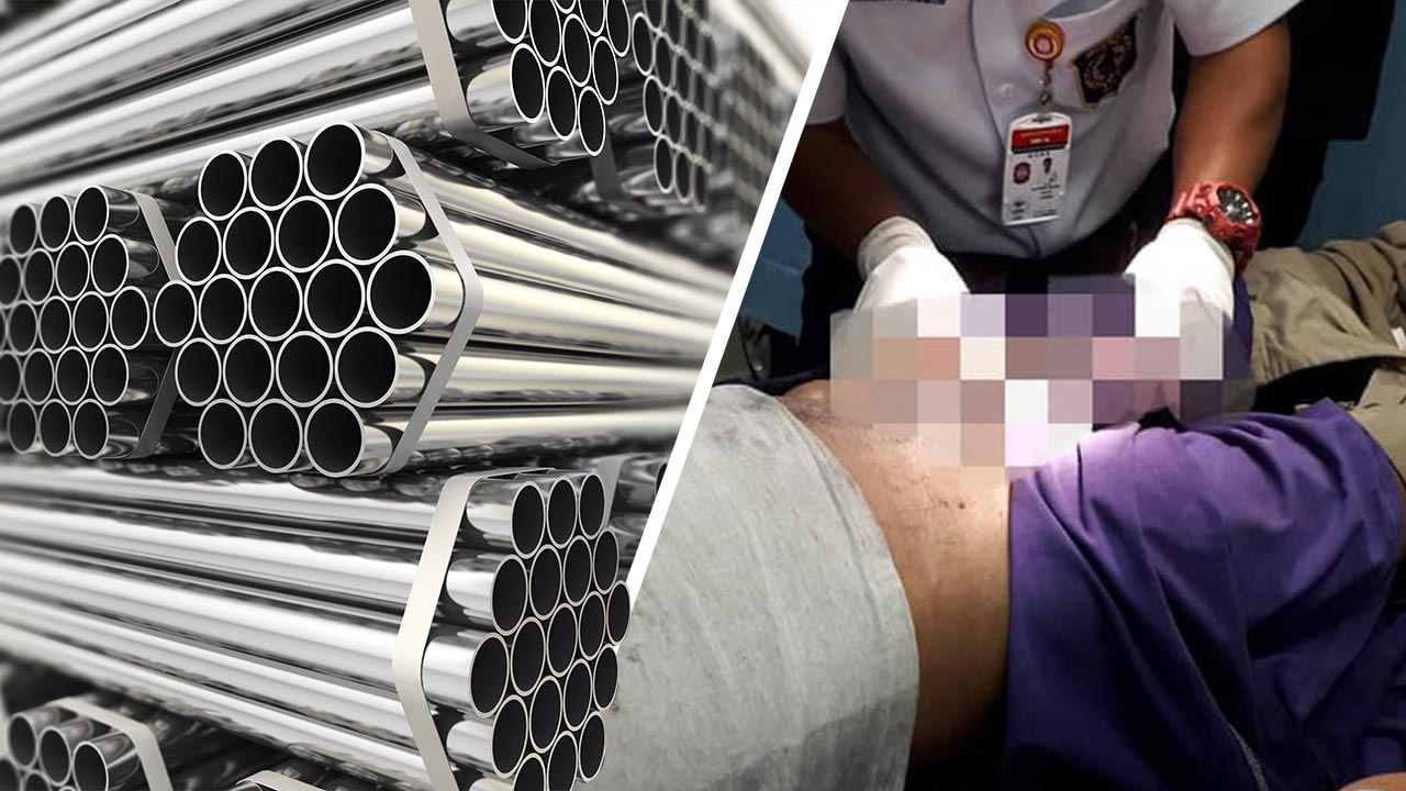 สำเร็จความใคร่ผิดที่ หนุ่มวัย 21 อวัยวะเพศติดท่อ 5 วัน เน่าต้องตัดทิ้ง