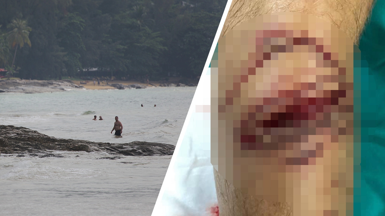 นักท่องเที่ยวผวา ถูกปลาขนาดใหญ่กัดขาเหวอะ หลังเล่นน้ำที่หาดนางทอง