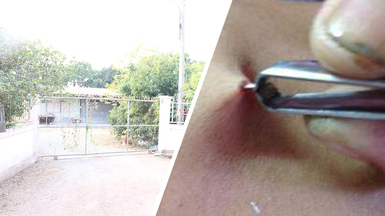 บุกบ้าน หมอจวบใช้แหนบดึงเส้นมะเร็ง เจ้าหน้าที่ตะโกนเรียกแต่ไร้คนตอบรับ