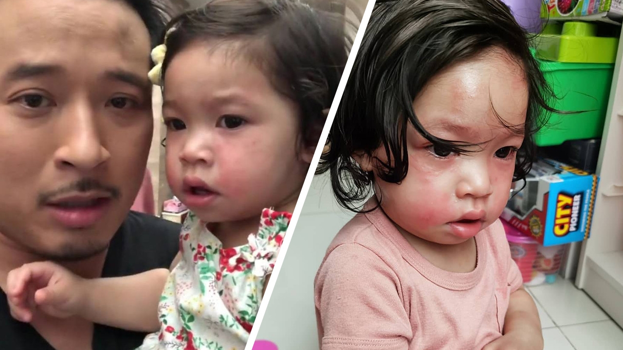 เบนซ์-มิค สงสาร น้องปราง แพ้นมวัวผื่นขึ้นแดง แค่สัมผัสยังไม่ได้ (คลิป)