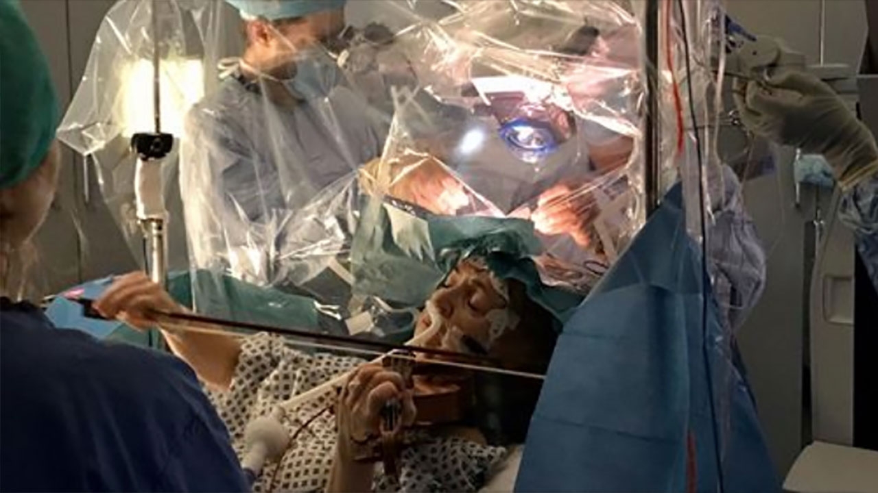 ผ่าตัดเนื้องอกพร้อมสีไวโอลิน