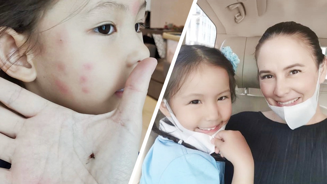 แอน อลิชา แสนเจ็บปวด น้องริชา มีตุ่มแดงขึ้นเต็มหน้า ค้นทั่วห้องตบคามือ