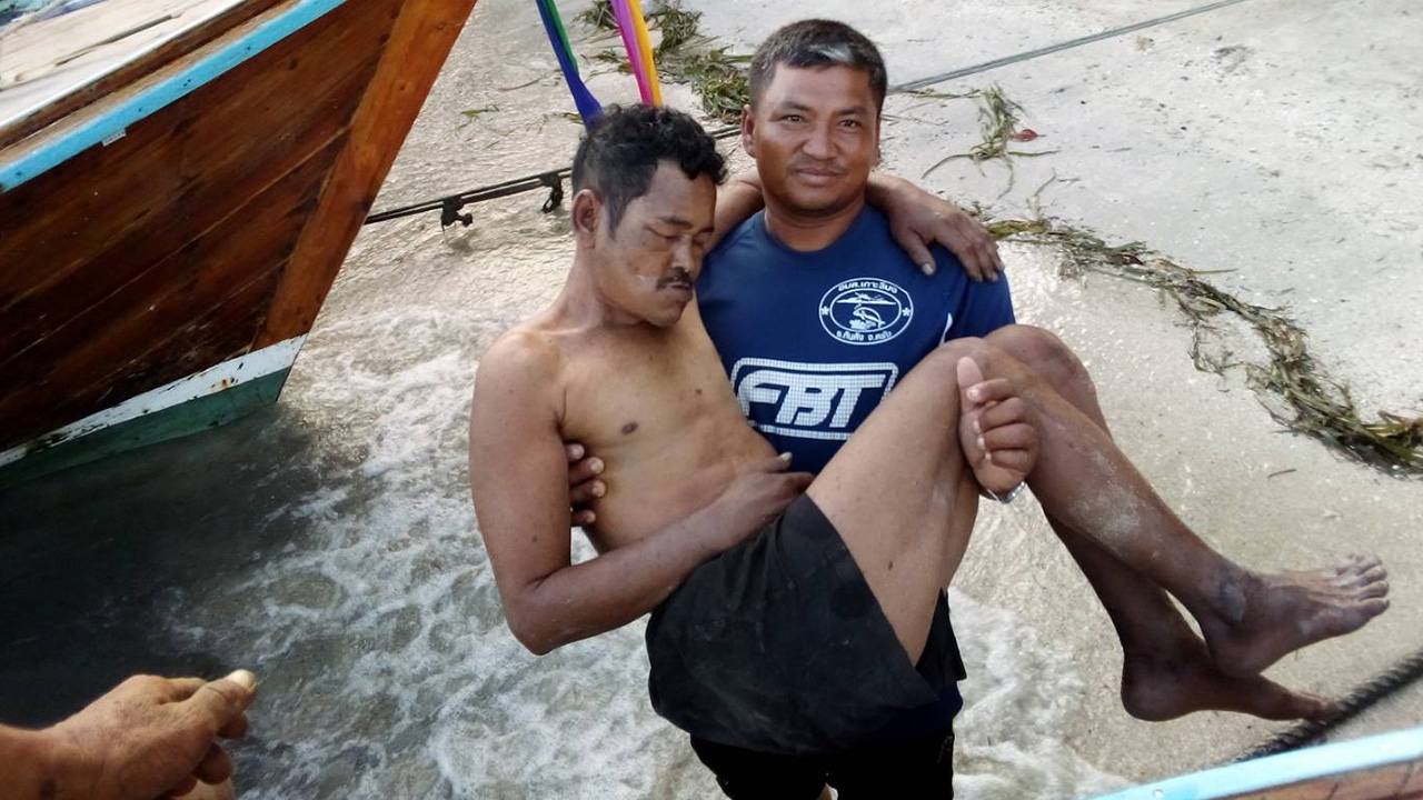 ผึ้งหลวงแตกรัง รุมต่อยหนุ่มใหญ่ หน้าตาปูดบวม อาการปางตาย