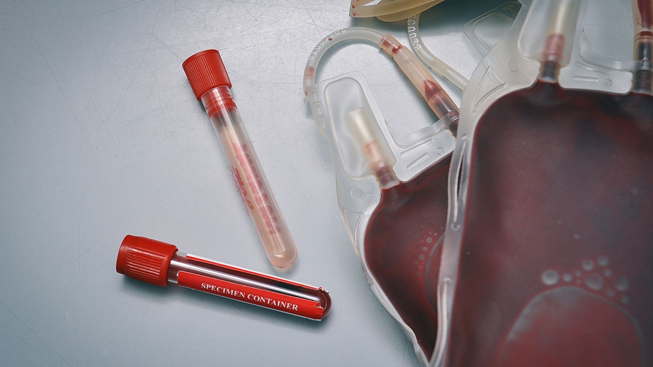 รพ.ศิริราช ชวนบริจาคเลือด หลังพบเลือดสำรองไม่พอจากสถานการณ์ "โควิด-19"