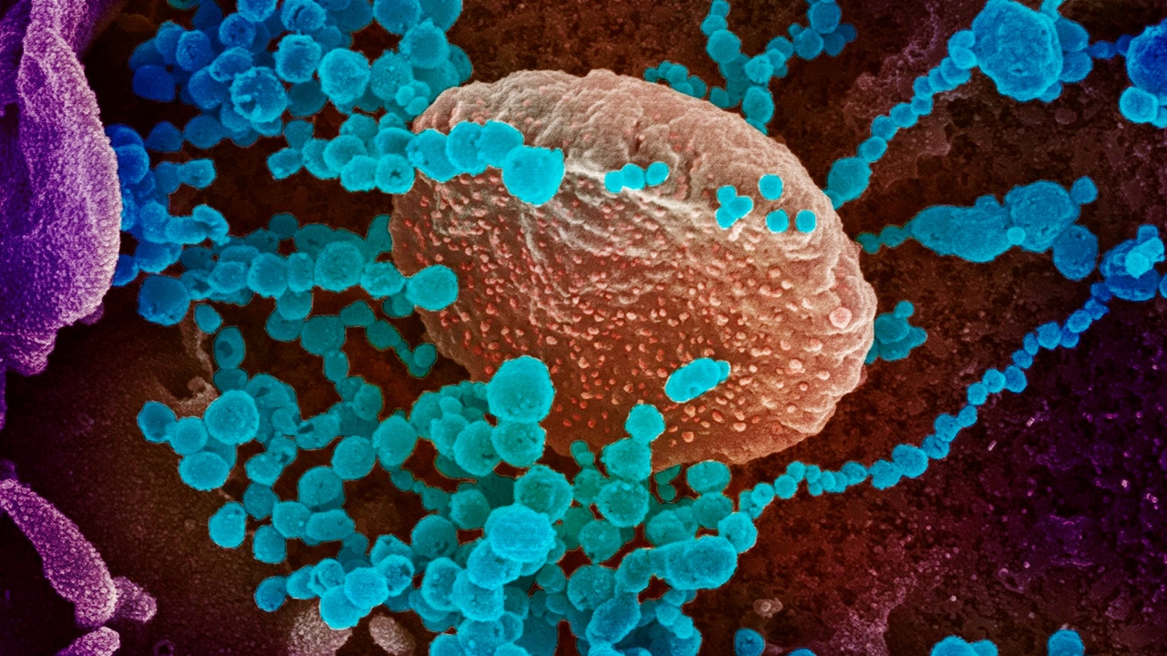 ผู้ติดเชื้อโควิด-19 สะสมทั่วโลกทะลุ 200,000 รายแล้ว ตายอีก 8,000 คน