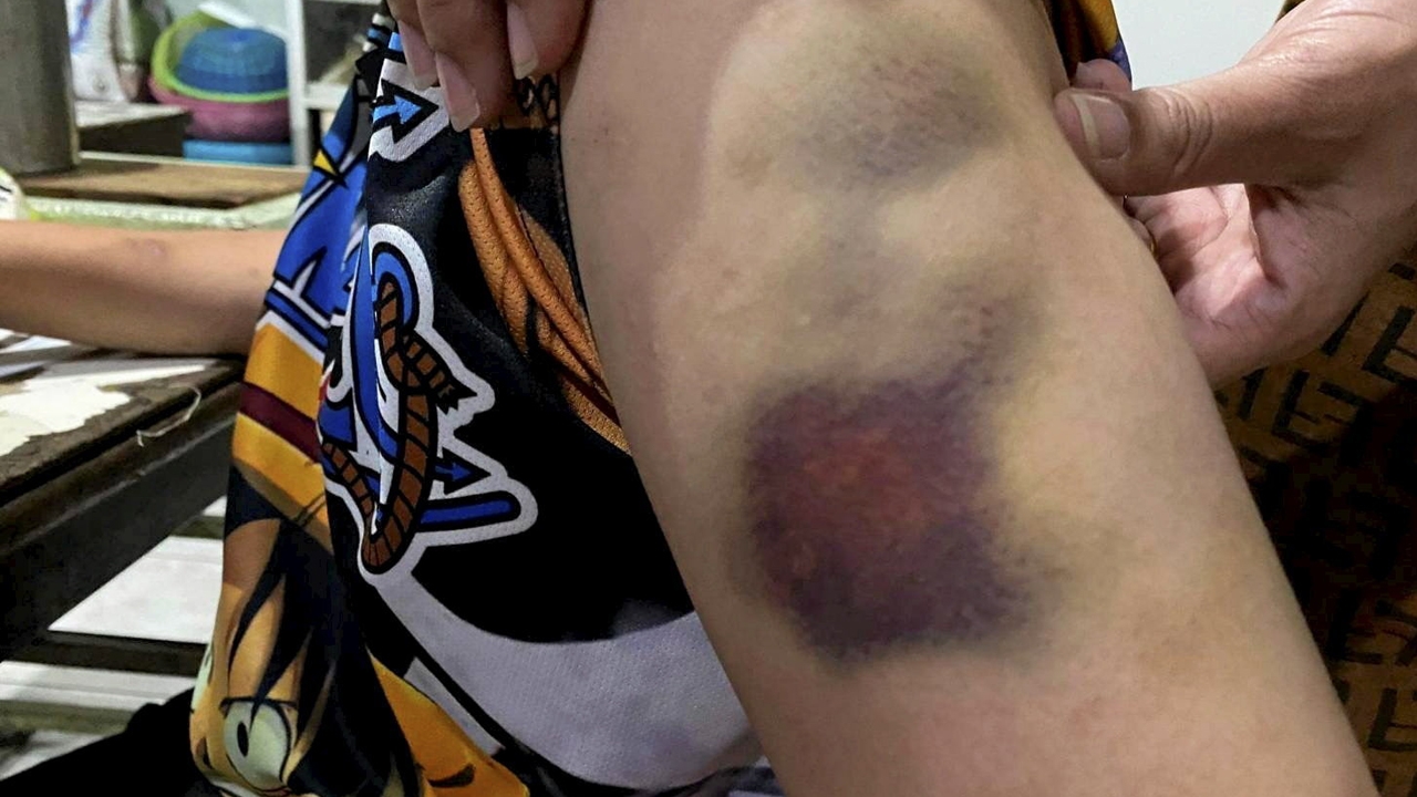 ครูนาฏศิลป์ ซ้อม ม.1 น่วม ต่อย-แทงเข่า อ้างหยอกล้อ