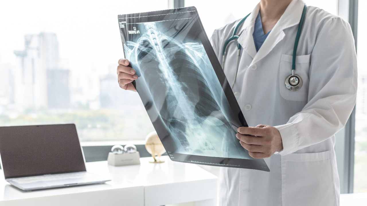 โควิด-19 กับ ภาวะระบบหายใจล้มเหลวเฉียบพลัน