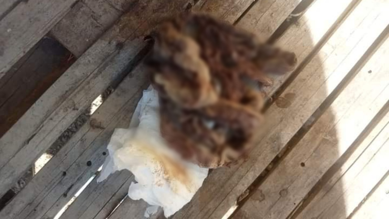 โรงพยาบาลแจง สาวโพสต์ประสบการณ์หลังคลอด เจอผ้าก๊อซยาวเป็นเมตรในช่องคลอด