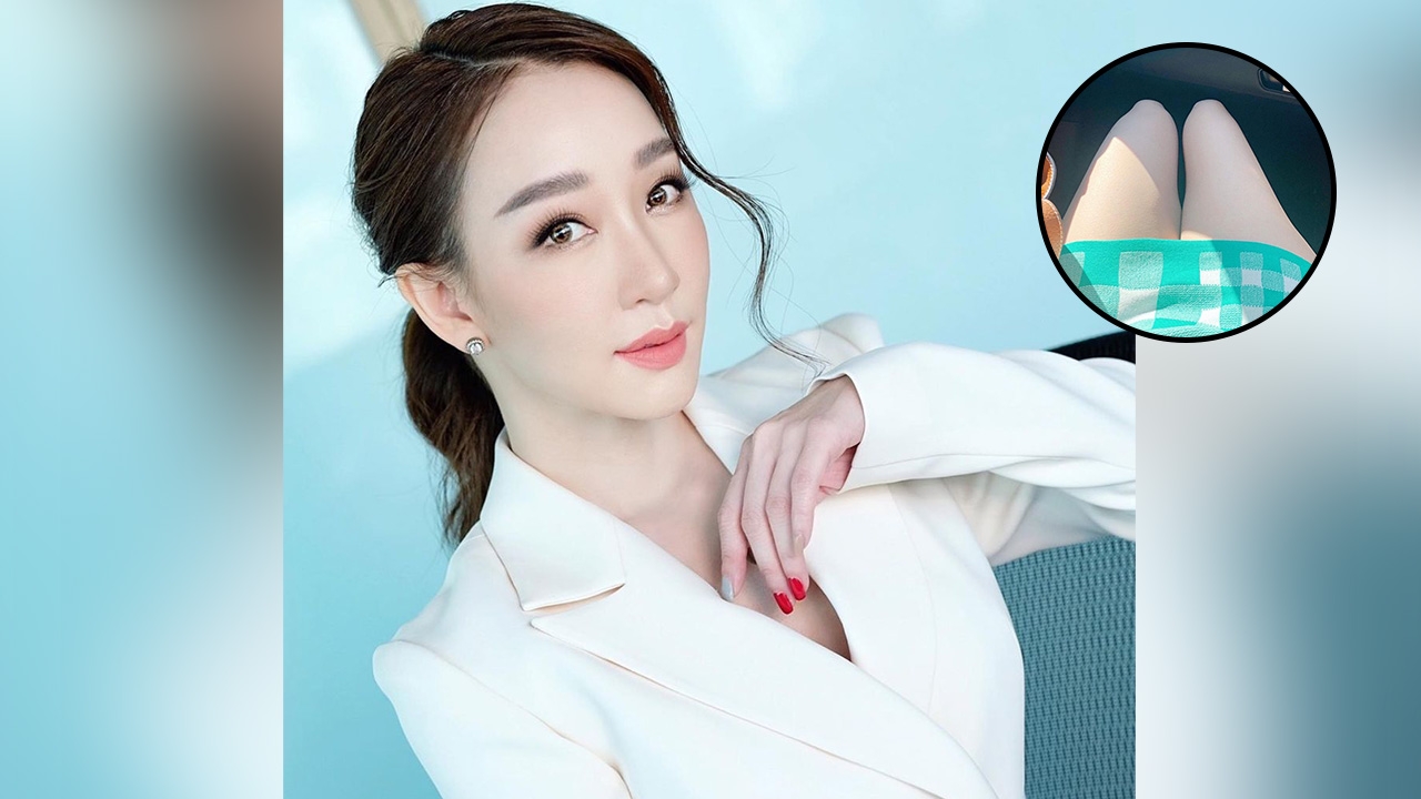 ตู่ ปิยวดี เผยภาพน่าตกใจกล้ามเนื้อขาลีบลง หลังเข้ารับการผ่าตัดหัวเข่า