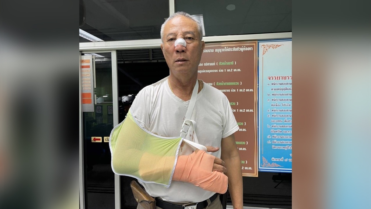 ร.ต.ท.โร่แจ้งความ โดนหนุ่มหัวร้อนรัวหมัดใส่หน้าบนโรงพัก เย็บไป 2 เข็ม