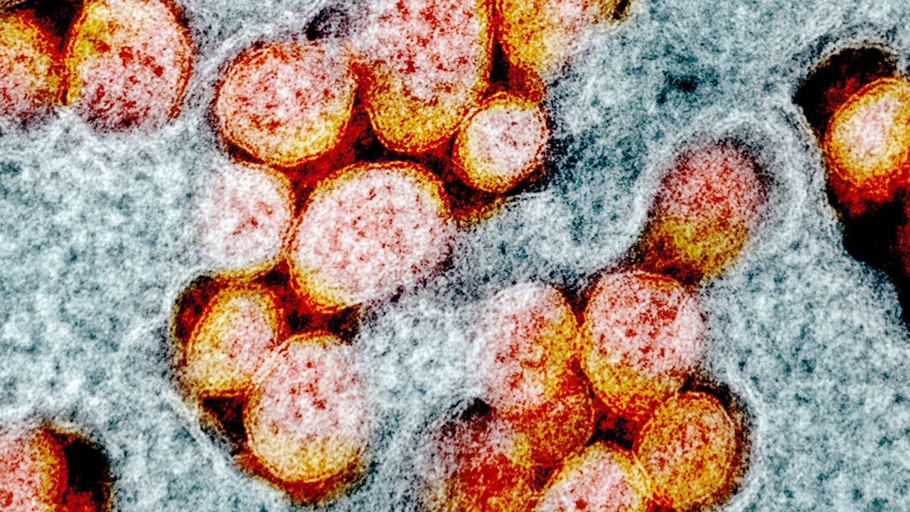 สุดผวา เตือนโควิดสายพันธุ์ใหม่ระบาดทั่วโลก ขณะนักวิทย์จับตา B.1.640