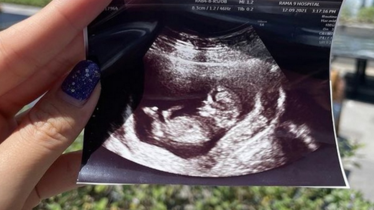 โต๋ ศักดิ์สิทธิ์ ทำชาวเน็ตสงสัย หลังแจ้งข่าวดี อะตอม ภรรยาน้องชายท้อง