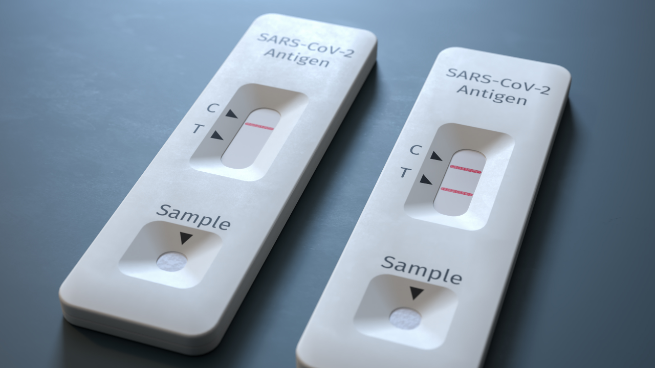 สธ. ย้ำซื้อ ATK ที่ผ่าน อย. ด้านองค์การเภสัชฯ ขายออนไลน์จำกัดคนละกล่อง