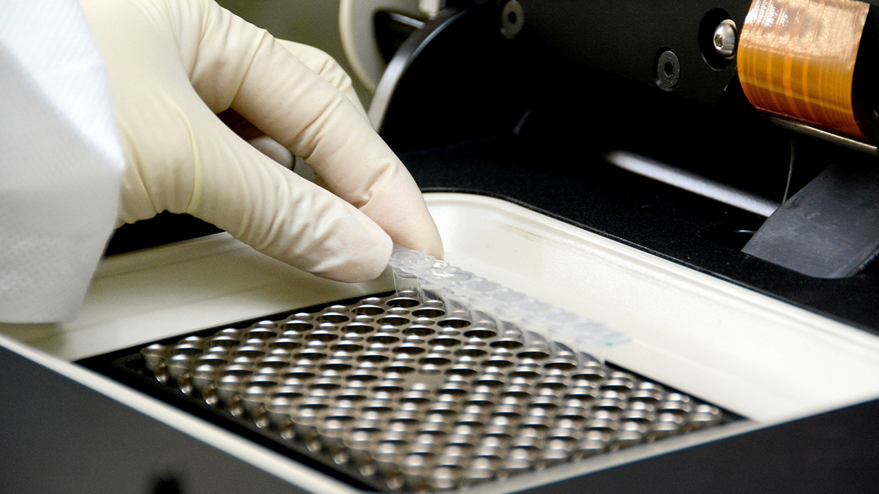 จากธนาคารเชื้อโรคสู่การ “ถอดรหัสพันธุกรรมจีโนม” พัฒนาชุดตรวจ “Real-time RT-PCR” 