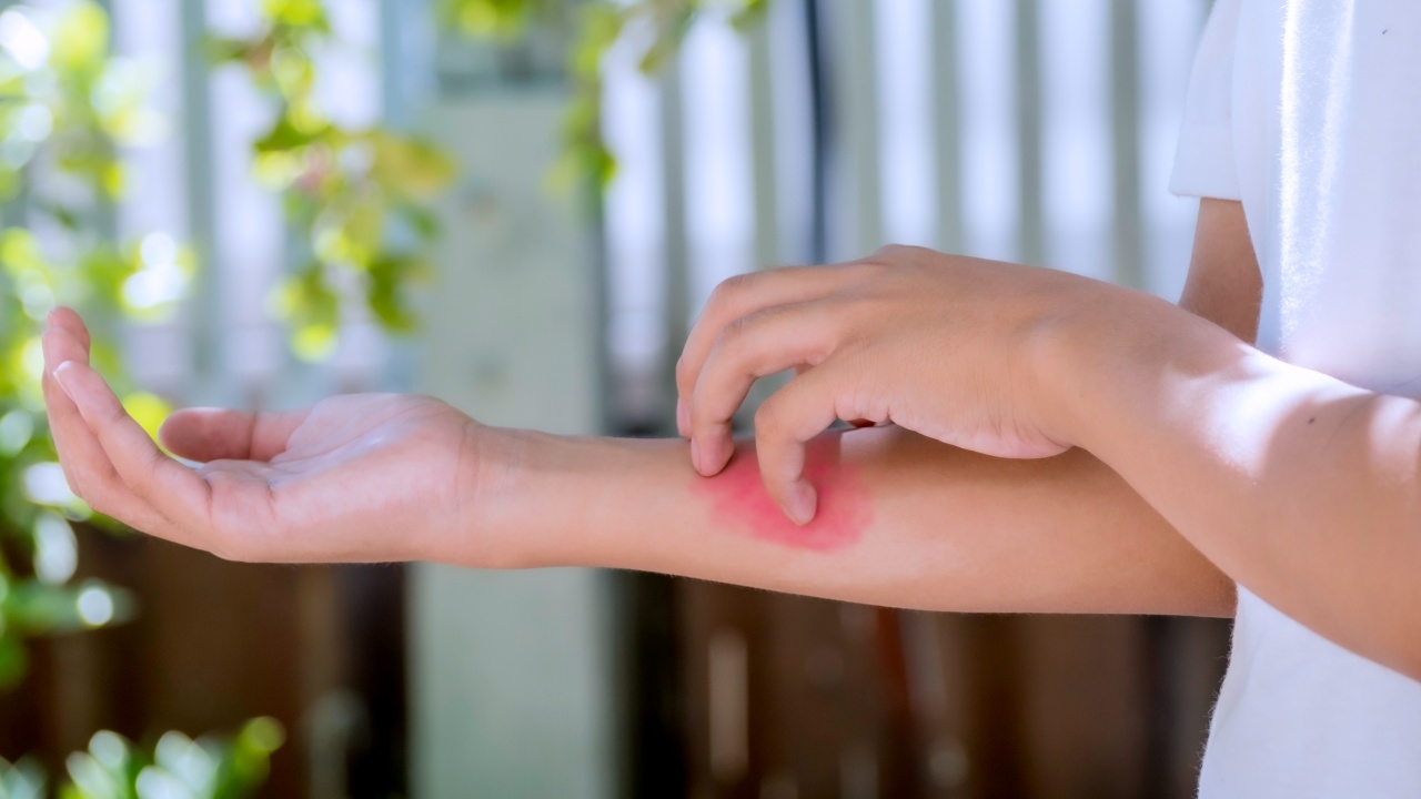 ไม่ไหวอย่าฝืน หมออธิบาย ทำไมอยู่ๆ แพ้อาหาร ทั้งที่เมื่อก่อน กินได้