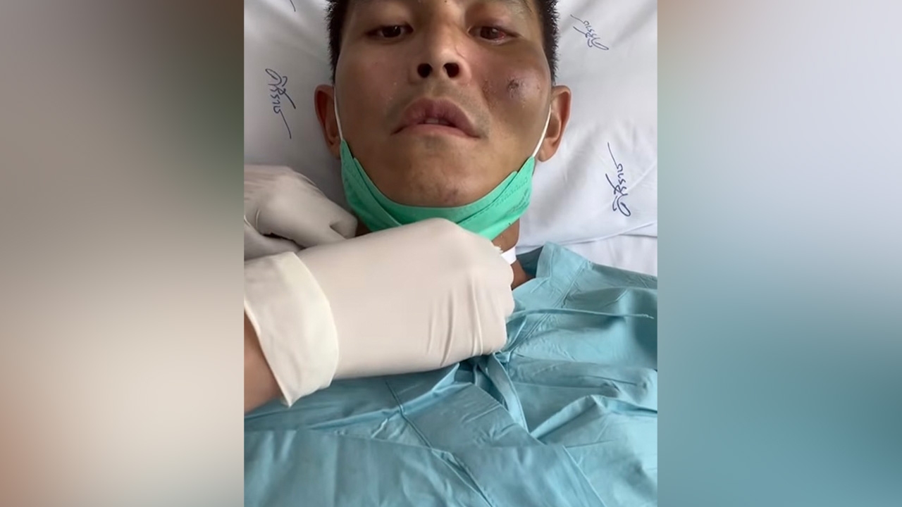 สงกรานต์ โพสต์ขอบคุณหมอช่วยรักษาจนได้กลับมาใช้ชีวิตใหม่