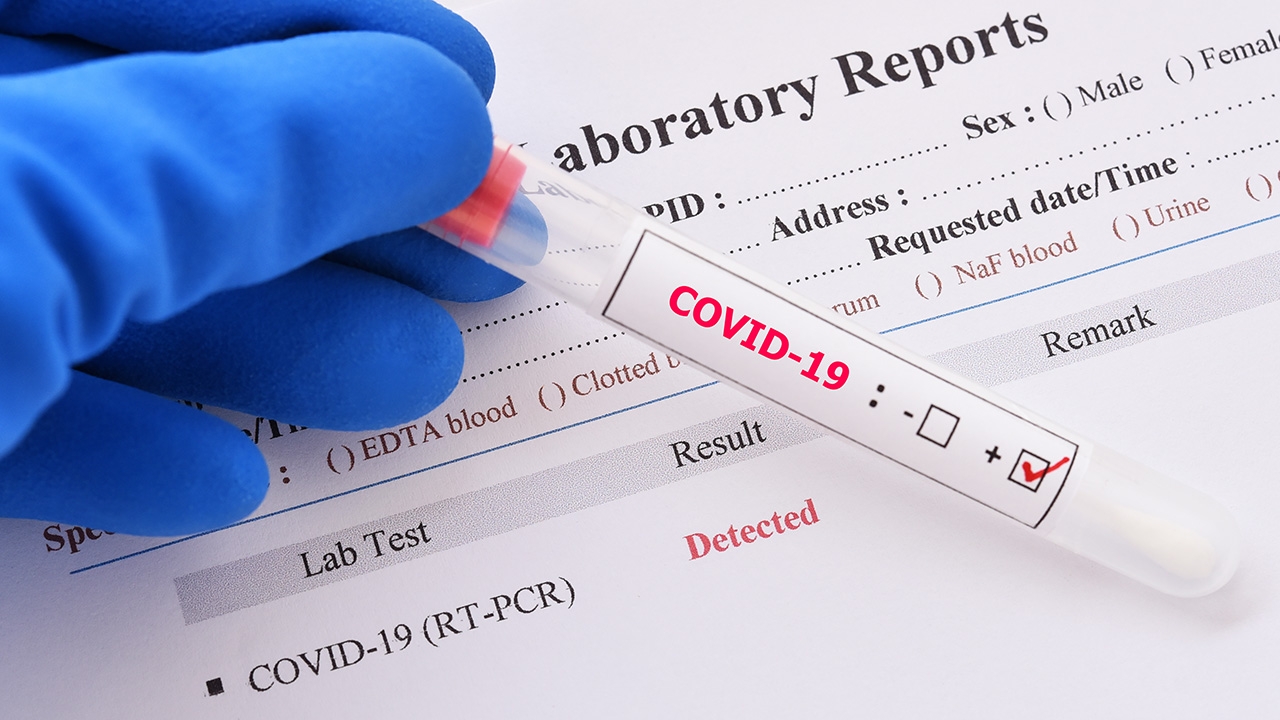 5 สาว BNK48 ป่วยโควิด อุบลเด็กติด 282 ทารก 4 เดือนดับ