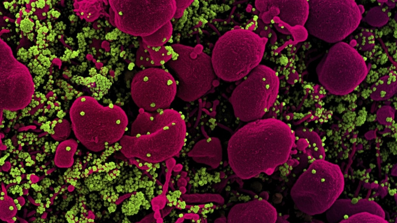 สวีเดนพบโควิดสุดร้าย เสี่ยงเกิดลิ่มเลือดอุดตัน นาน 6 เดือน หลังติดเชื้อ