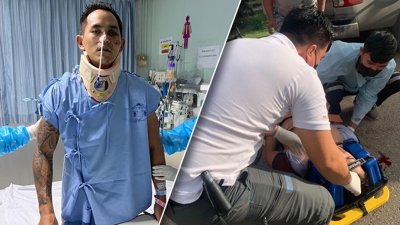 สงกรานต์ โพสต์ภาพตอนเกิดอุบัติเหตุวันแรก ภาพชัดเจนว่าเจ็บหนัก