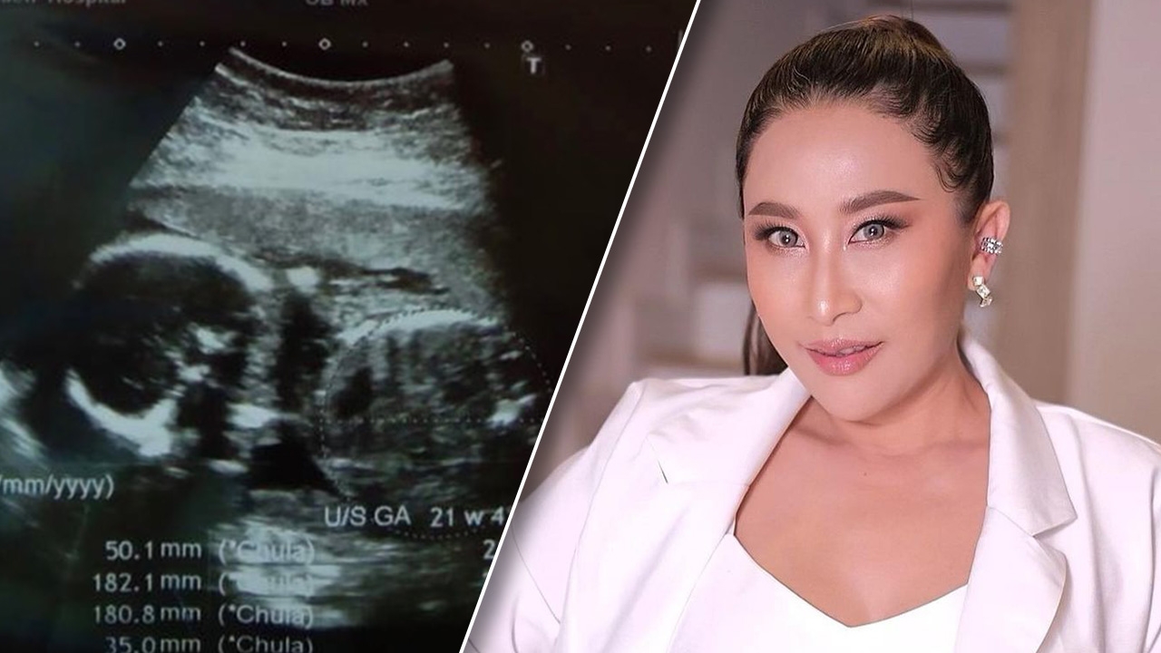 ลาล่า อาร์สยาม โพสต์ภาพอัลตราซาวนด์ บอกอีก 4 เดือนเจอกัน แฟนๆ ยินดี