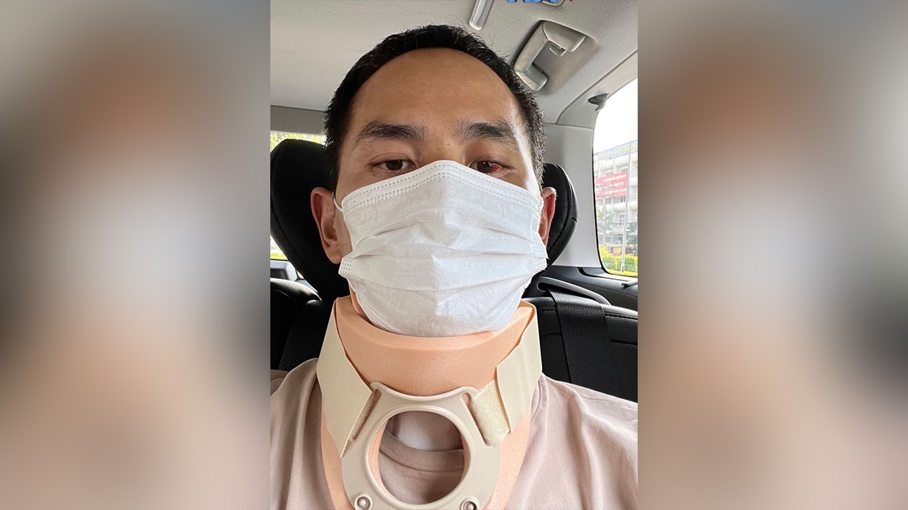 สงกรานต์ เผยภาพล่าสุด และข่าวดีหลังประสบอุบัติเหตุปั่นจักรยานชนรถยนต์